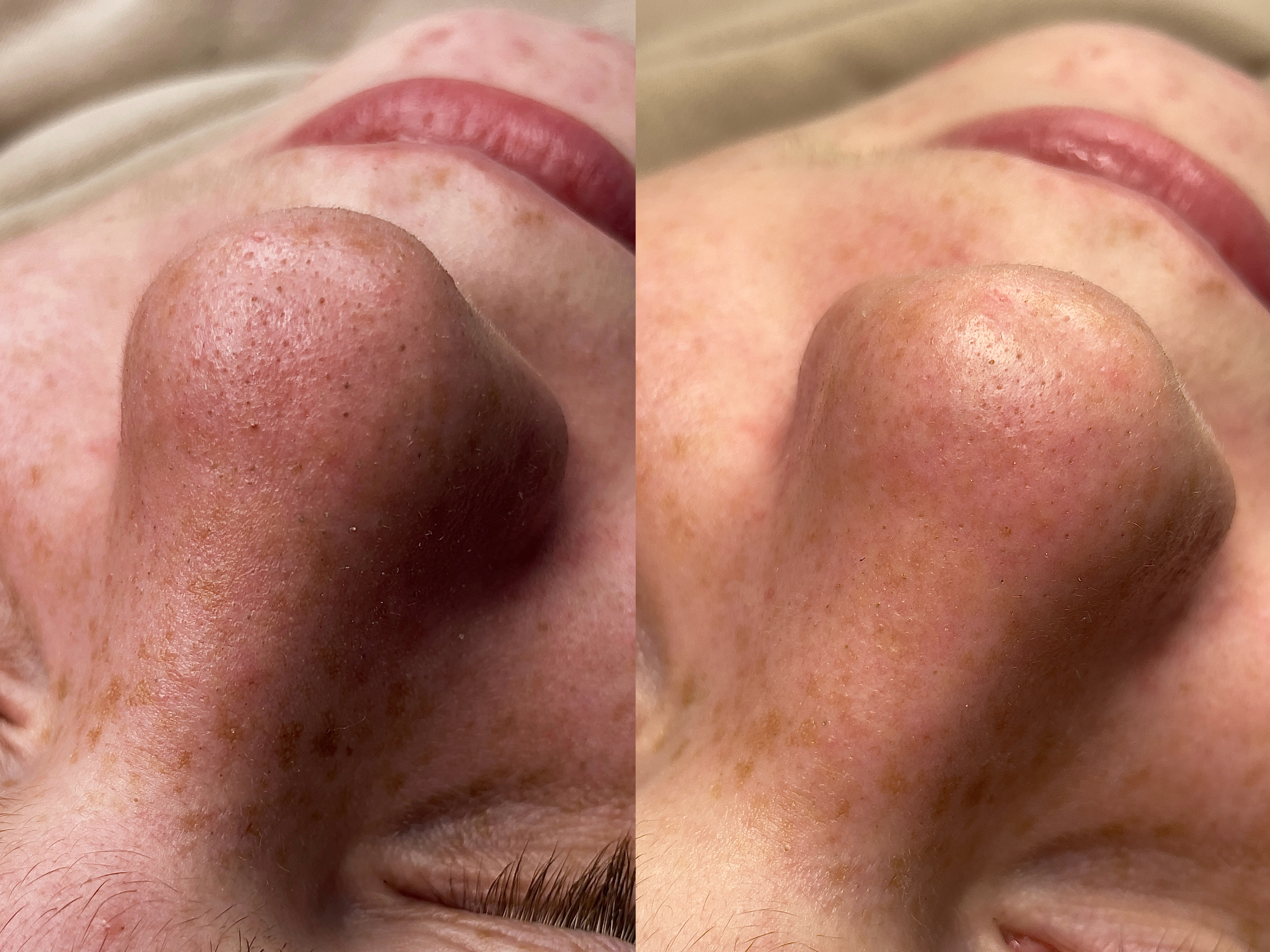 Pielęgnacja - Efekt 3